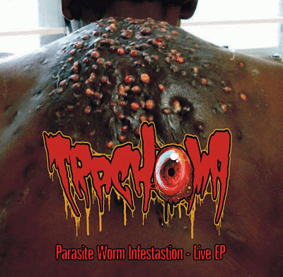 Trachoma : Parasite Worm Infestation - Live EP